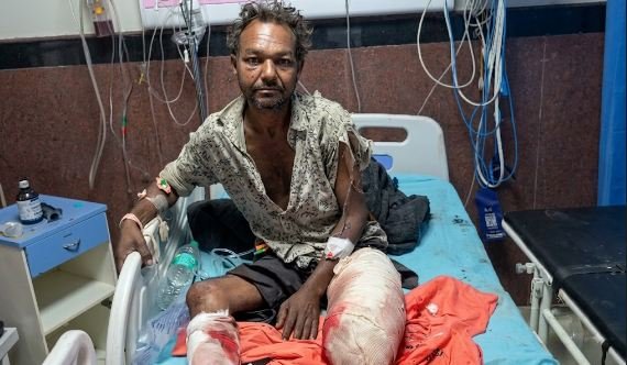 दीगोद स्टेशन पर चलती ट्रेन में चढ़ने के प्रयास में नीचे गिरा यात्री: चपेट में आने से दोनों पैर कटे, एमबीएस अस्पताल में भर्ती