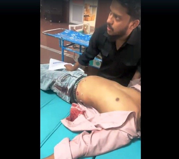 गुमानपुरा थाने के सामने फाइनेंस कर्मचारी पर चाकू से हमला, पेट में लगा चाकू
